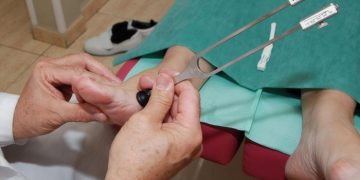 La Junta financia casi 73.000 servicios de podología itinerante para personas mayores