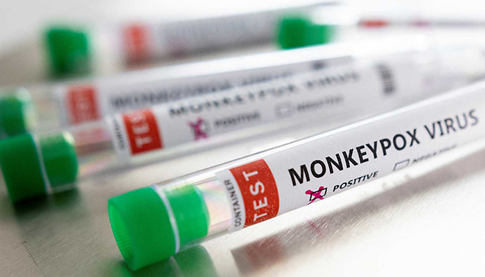 Castilla-La Mancha registra el segundo caso de viruela de mono
